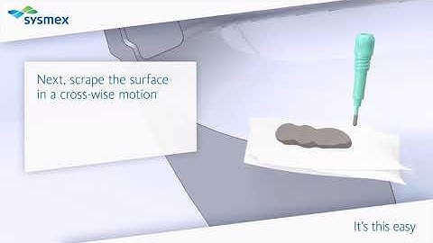 Fecal Occult Blood, Sentifit Collection Instructions