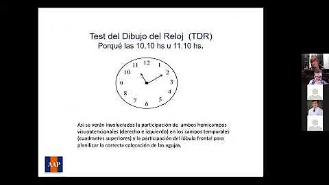 ¿Qué es la prueba de la esfera del reloj en la demencia?