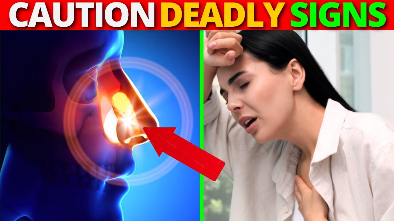 YOU ARE A DIABETIC, NEVER IGNORE THESE 7 DEADLY SIGNS OF KETOACIDOSIS. YOU ARE A DIABETIC, NEVER IGNORE THESE 7 DEADLY SIGNS OF KETOACIDOSIS.