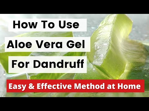 How To Use Aloe Vera Gel For Dandruff Treatment At Home - Best & Effective Dandruff Removal At Home