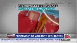 CNN Live features AcceleDent as One of the Best Products from 2014 CES