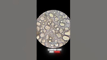 Duck egg under the microscope 🦆🔬😱#shorts #education #duck #egg #undermicroscope #microscope #saint