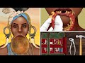 Asmr pimple popping lip plates for the mursi tribes woman  treatment animation