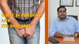 What to do when Foreskin does not retract | Understanding Phimosis Treatment