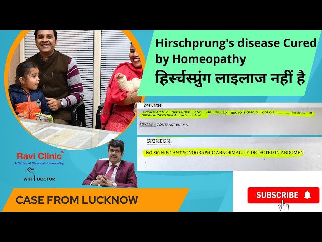 Hirschprung's Disease Cured in a month with Homeopathy Dr Ravi Singh