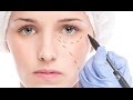 Безоперационная подтяжка лица в Краснодаре - омоложение лица