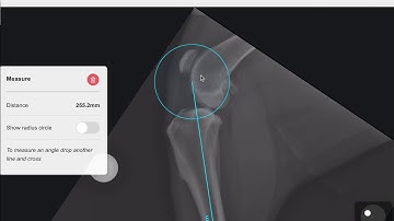 3 Measuring Distance in vPOP-pro