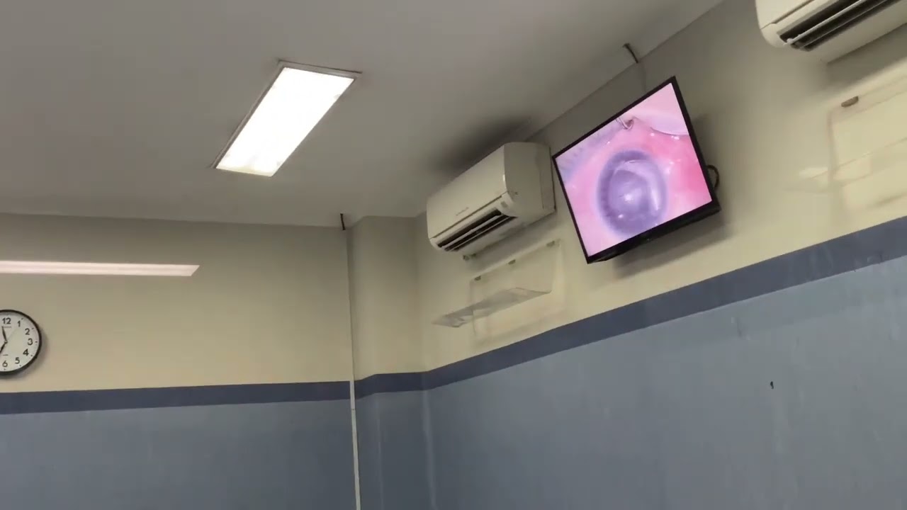 Operasi Lasik kilat RSI Sultan Agung Semarang 1 mata 6 menit jadi  # 2