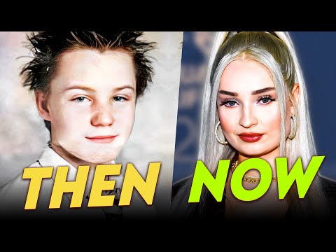 Kim Petras | Before x After | Her Full Transformation