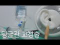 소리집중 ASMRㅣ매우 생생 자극ㅣ팅글관 교정술ㅣ수술ㅣsurgery ASMR