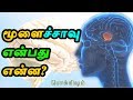 What is brain death  what is meant by brain death tpexc18  tamil pokkisham