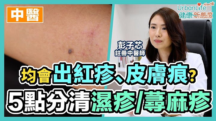 【蕁麻疹原因】要戒口嗎？均會出紅疹、皮膚痕？中醫角度如何區別濕疹、蕁麻疹 - 天天要聞
