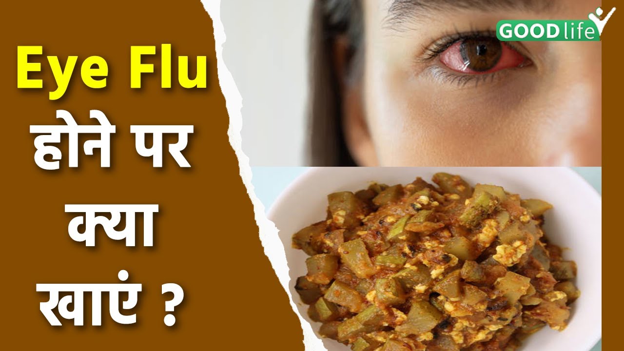 Eye Flu Hone Par Khaye Eye Flu Diet in Hindi Eye Flu Home Remedies Good Life YouTube