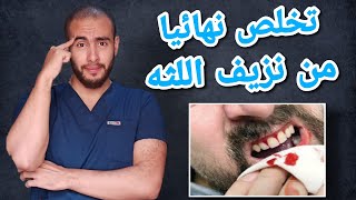 اسباب وعلاج التهاب ونزيف اللثه | علاج التهاب اللثه وانتفاخها