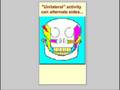 Definition of Bruxism Definition of Bruxism