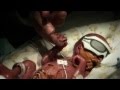 24 week premature baby - Toby's journey