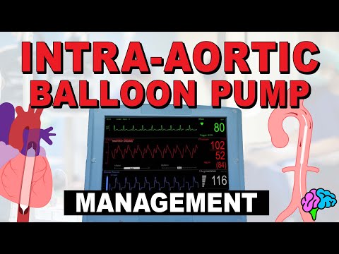 Management of the Intra-Aortic Balloon Pump