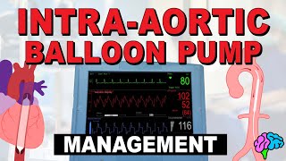 Management of the Intra-Aortic Balloon Pump (IABP)