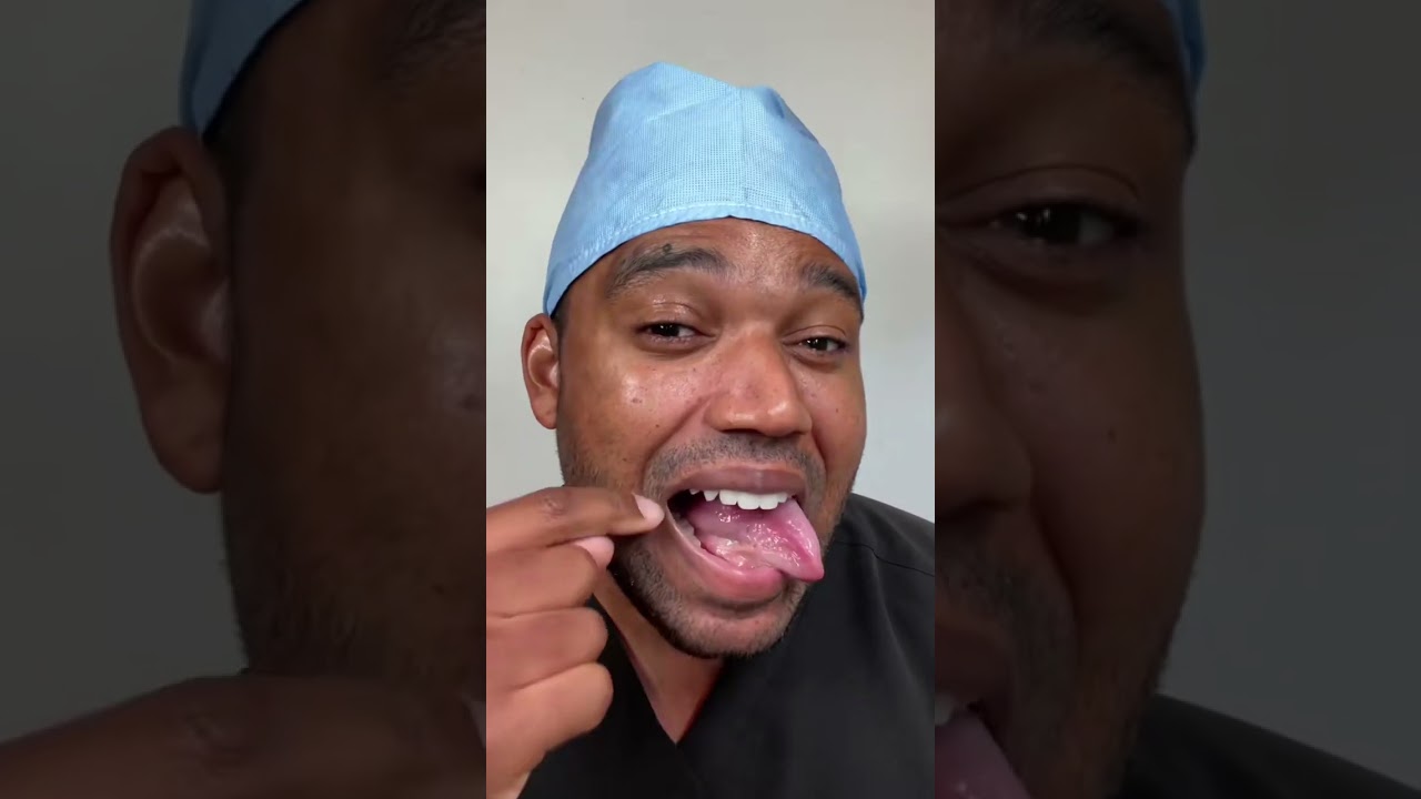 Oral cancer, if found early is completely treatable