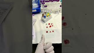 🧪lab life : where science meets precision. #fyp, #viral ,#trending ,#explorepage