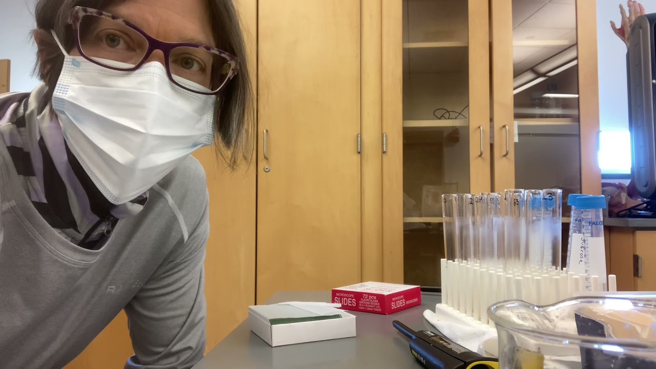 Yeast Viability Assay Setup YouTube