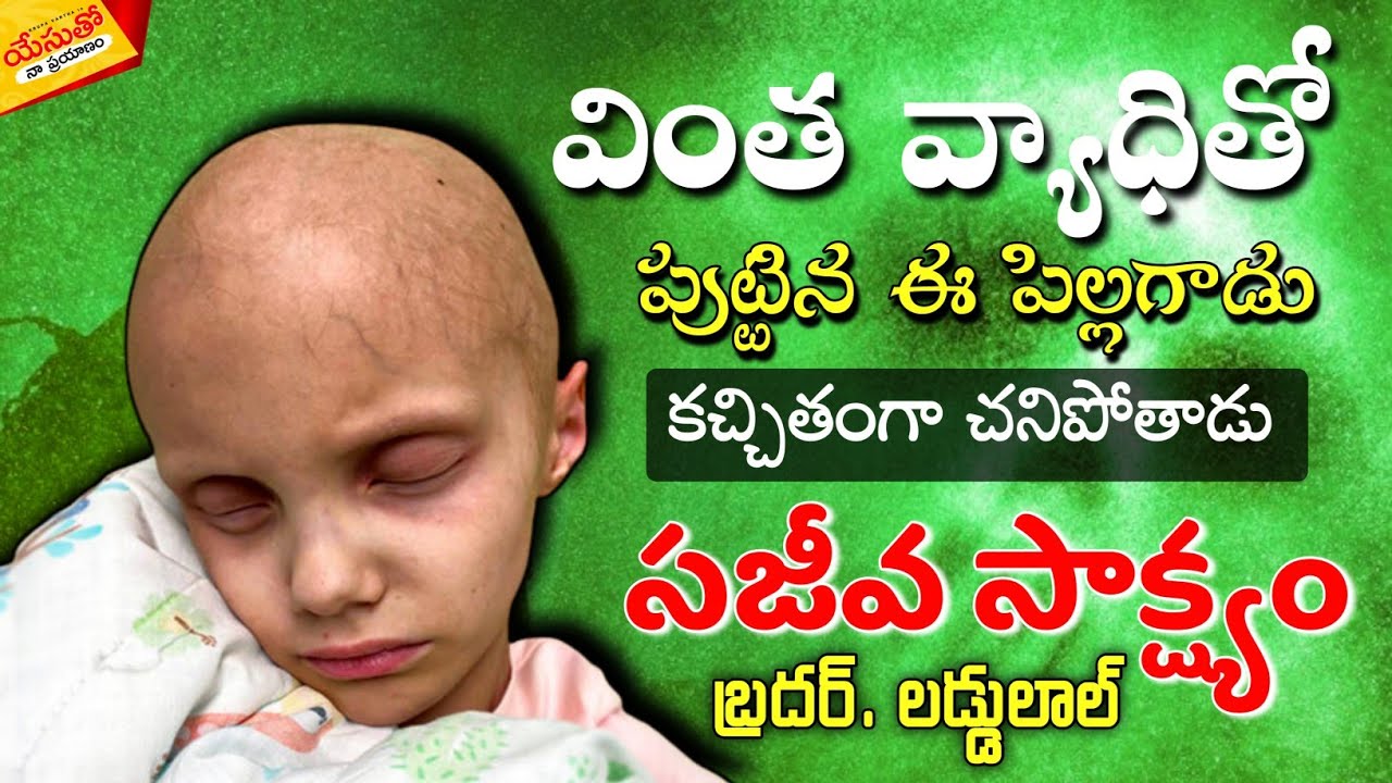 #వింత #వ్యాధితో పుట్టిన ఈ పిల్లగాడు కచ్చితంగా చనిపోతాడు #Testimony #Yesutho_Naa_Prayanam