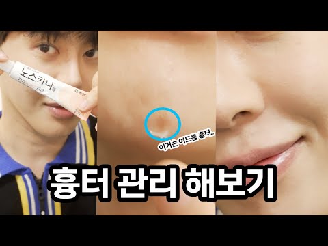여드름 <strong>흉터</strong> 커버 <strong>메이크업</strong> (광고)
