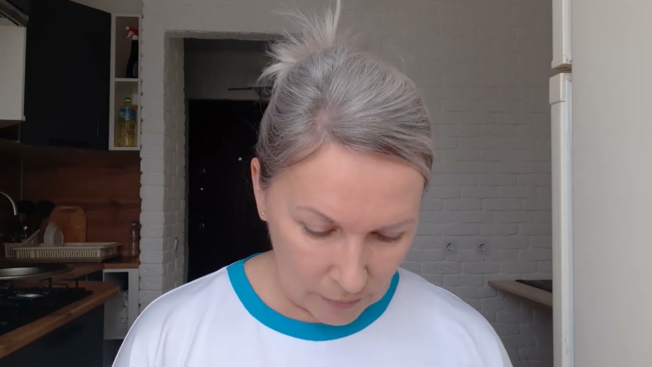 Блефаропластика спустя полгода. Отвечаю на ваши вопросы.