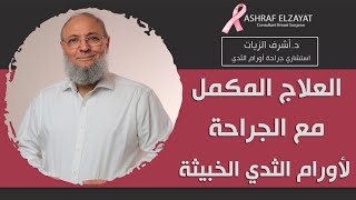 العلاج المكمل مع الجراحة لأورام الثدي الخبيثة/ دكتور أشرف الزيات