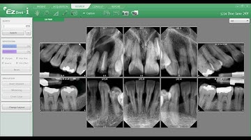 EZDent i, Chapter 03 04   Change Layout FINAL