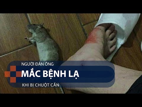 Người đàn ông mắc bệnh lạ khi bị chuột cắn | VTC1