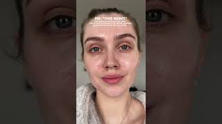 Skin Texture Is Normal