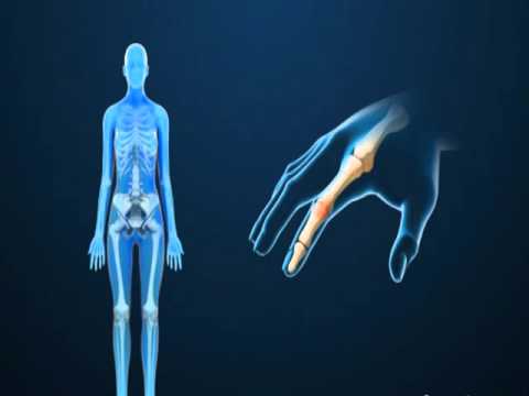 Video: Artro-Active - Navodila Za Uporabo, Indikacije, Odmerki, Analogi