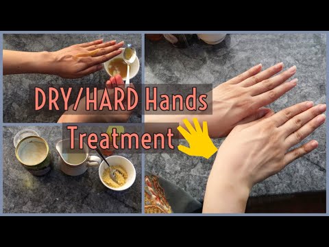 DRY Hands Treatment at Home | Treat Hard Hands, Rough Hands, Anti Aging Mask 🙌 Hindi/Urdu
