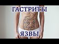 Гастриты и язвы желудка, кишечника | 10 шагов для восстановления ЖКТ