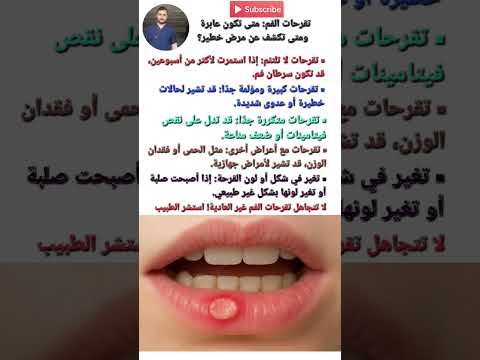 تقرحات الفم متى تكون عابرة ومتى تكشف عن مرض خطير صحة