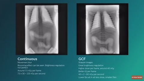Philips Grid-controlled fluoroscopy (GCF) animation video