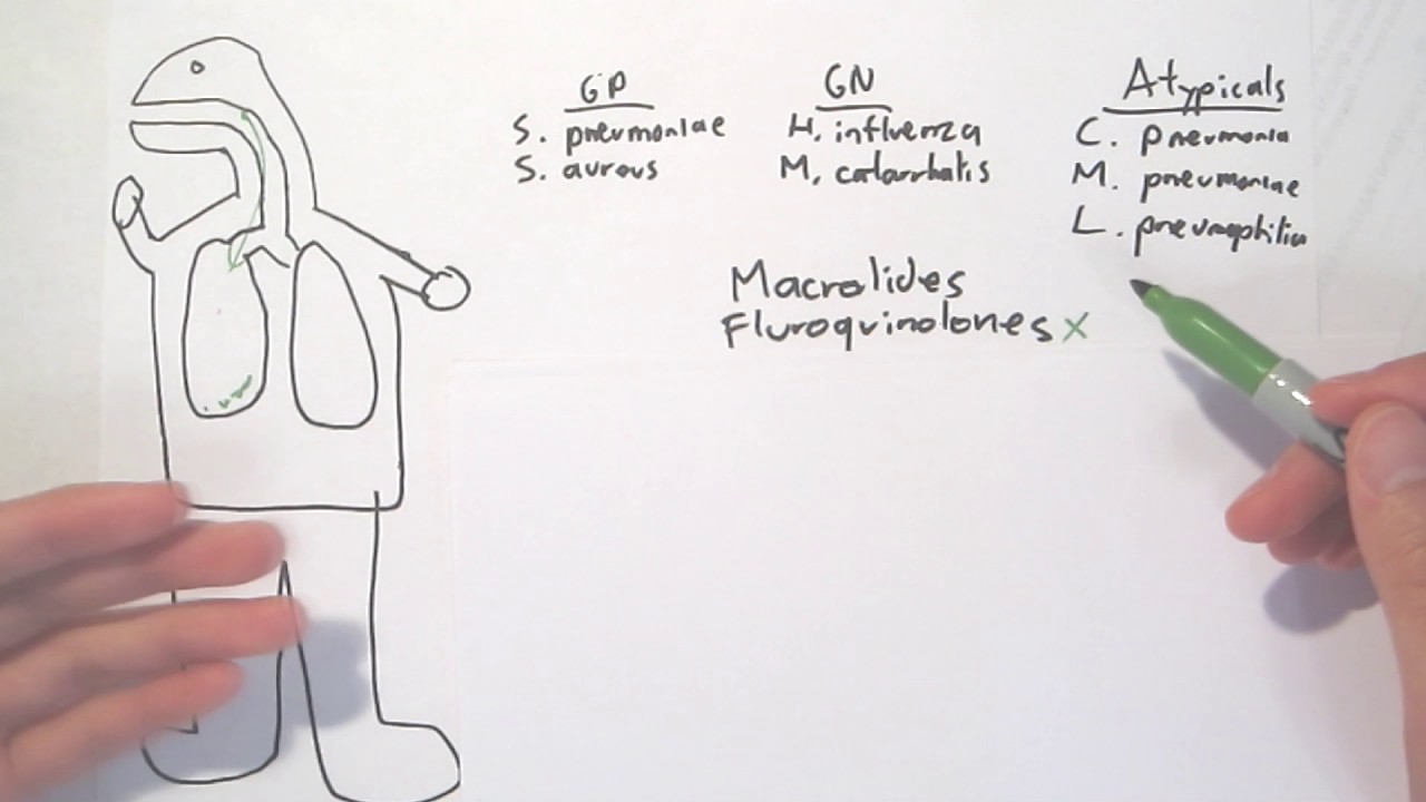 How to Diagnose and Treat Pneumonia 