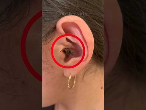 Something Lived In Her Ear