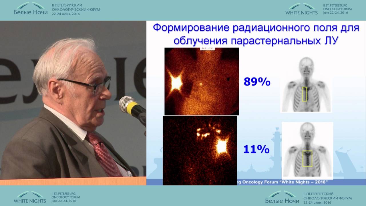 Адъювантная лучевая терапия при раннем РМЖ. Показания к назначению ...