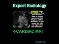Cardiac MRI 4 chamber view #radiology - Naresh gehlot #mri #medicalimaging