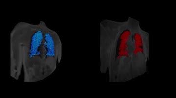 OE-MRI & DCE-MRI side by side.