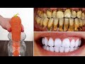 Sadece 2 Dakika İçinde Sarı Kirli Dişler Süt Gibi Beyaz ve Parlak Hale Gelecek | Evde diş tedavisi..