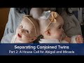 Separating Conjoined Twins Part 2: A House Call for Abigail and Micaela