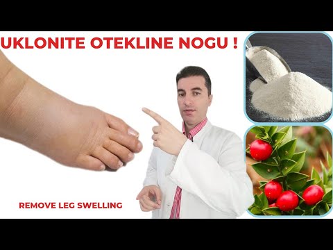 Video: Ali bi morali jemati holin med nosečnostjo?