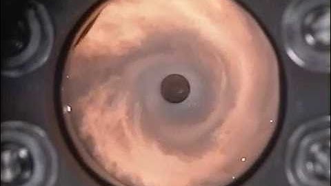 Combustion Seen In Slow Motion