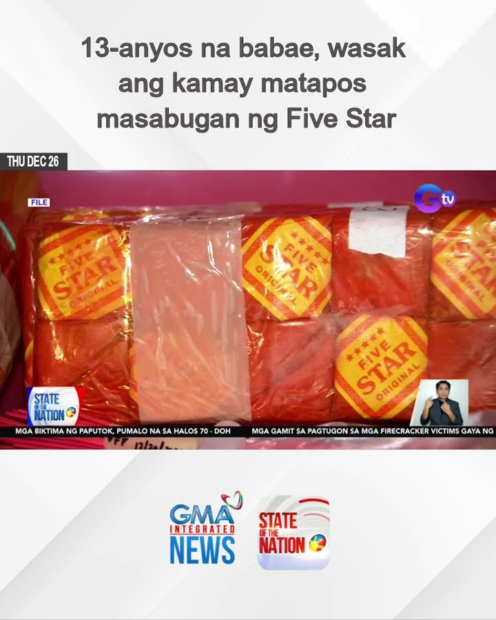 13-anyos na babae, wasak ang kamay matapos masabugan ng Five Star | SONA