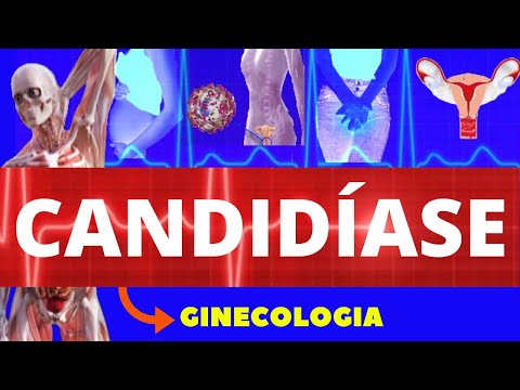 CANDIDÍASE (CAUSAS, SINTOMAS E TRATAMENTO) - GINECOLOGIA - CANDIDÍASE DE REPETIÇÃO