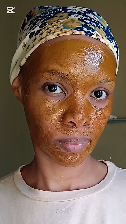 honey & cinnamon mask for acne, get rid of acne in 7 days, how to get glass skin, hyperpigmentation