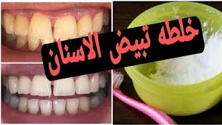 خلطه الاسنان الجبارة اللى هتخلى اسنانك فله 